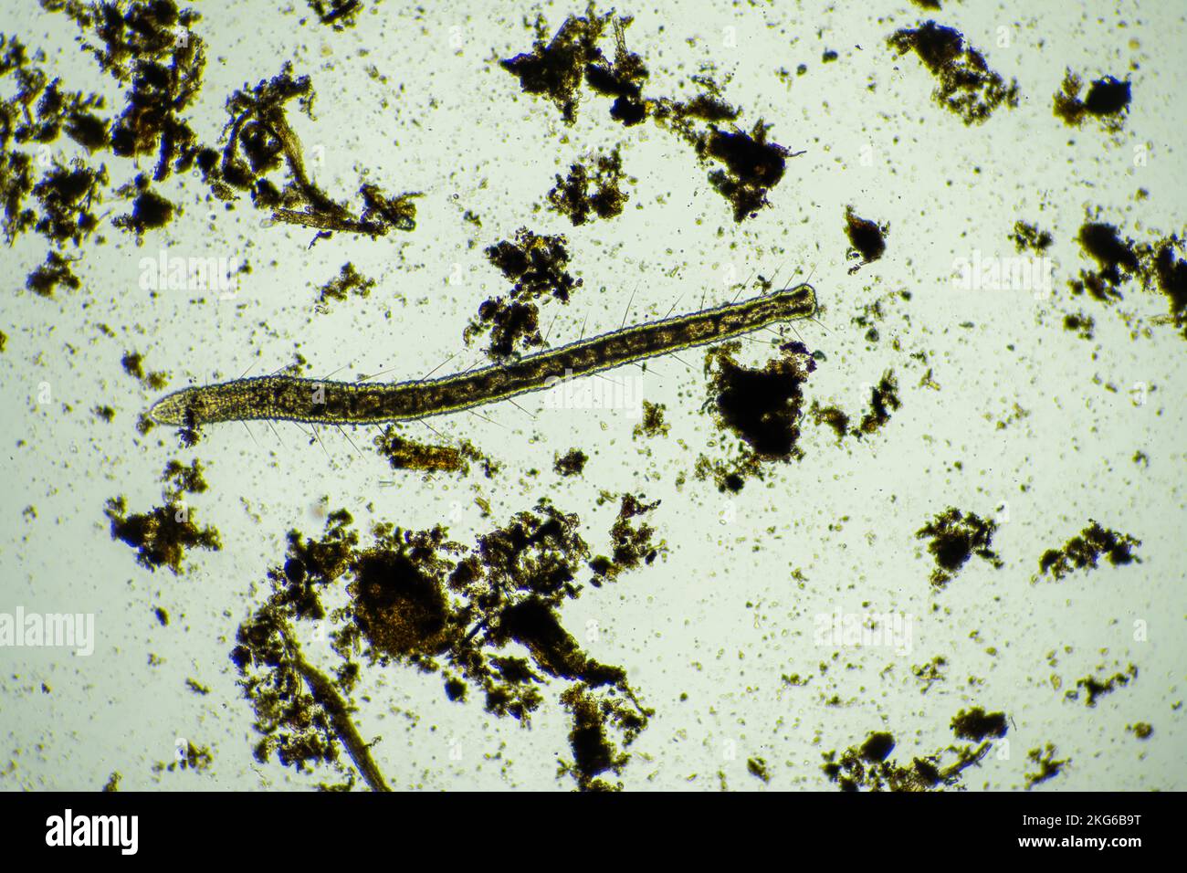 parassita umano. malattia da infezione intestinale. infezione da microrganismi in ospedale nelle persone Foto Stock