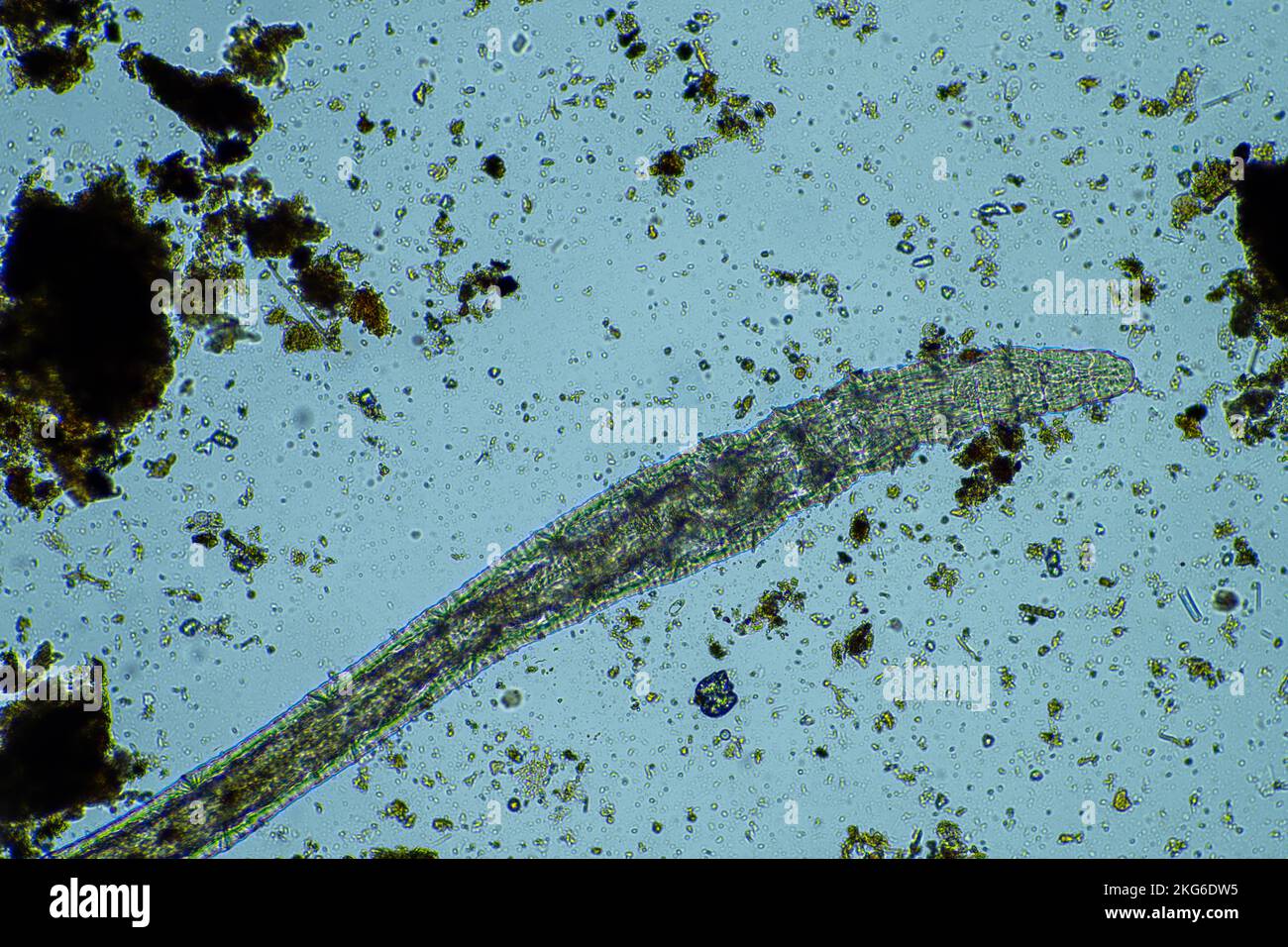 parassita umano. malattia da infezione intestinale. infezione da microrganismi in ospedale nelle persone Foto Stock