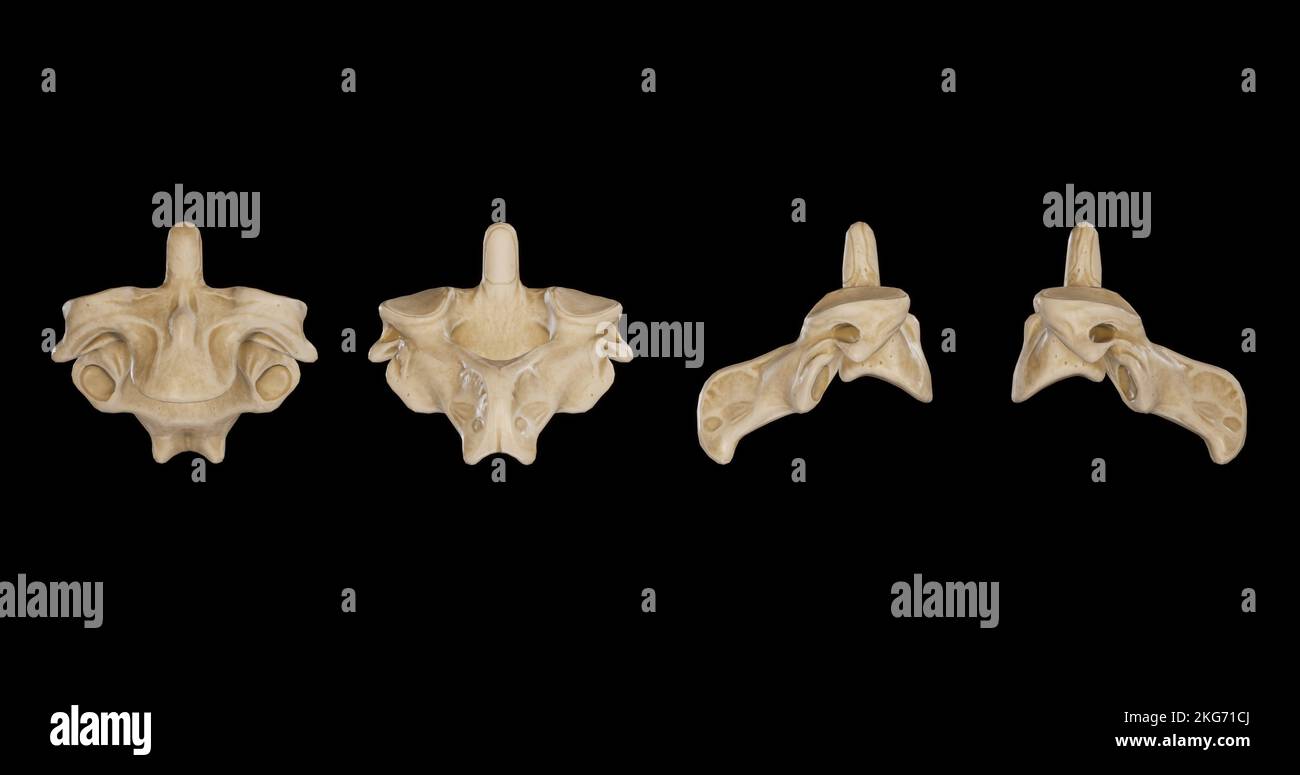 Seconda vertebra cervicale (asse) - multipla Views.jpg Foto Stock