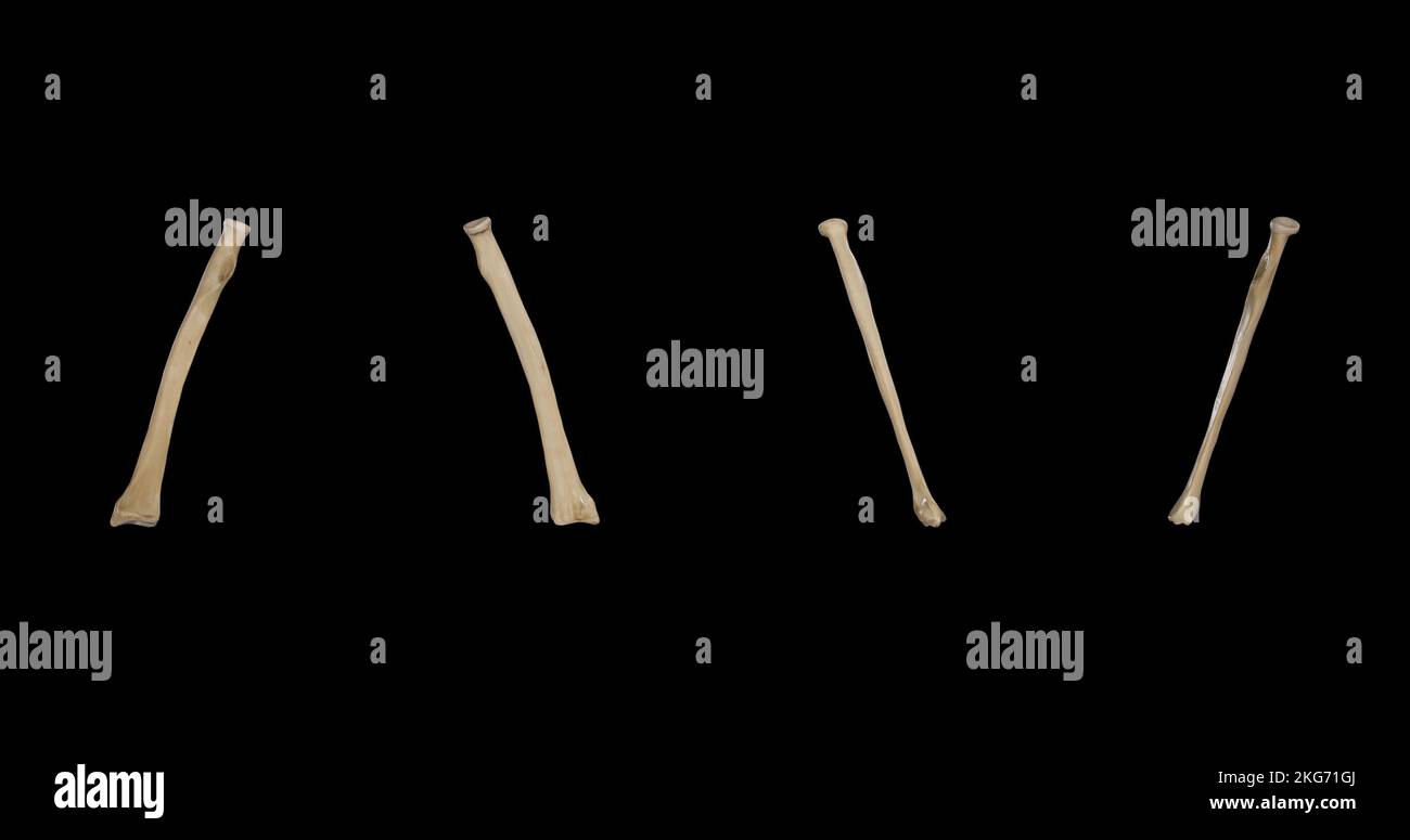 Raggio destro - viste multiple Foto Stock