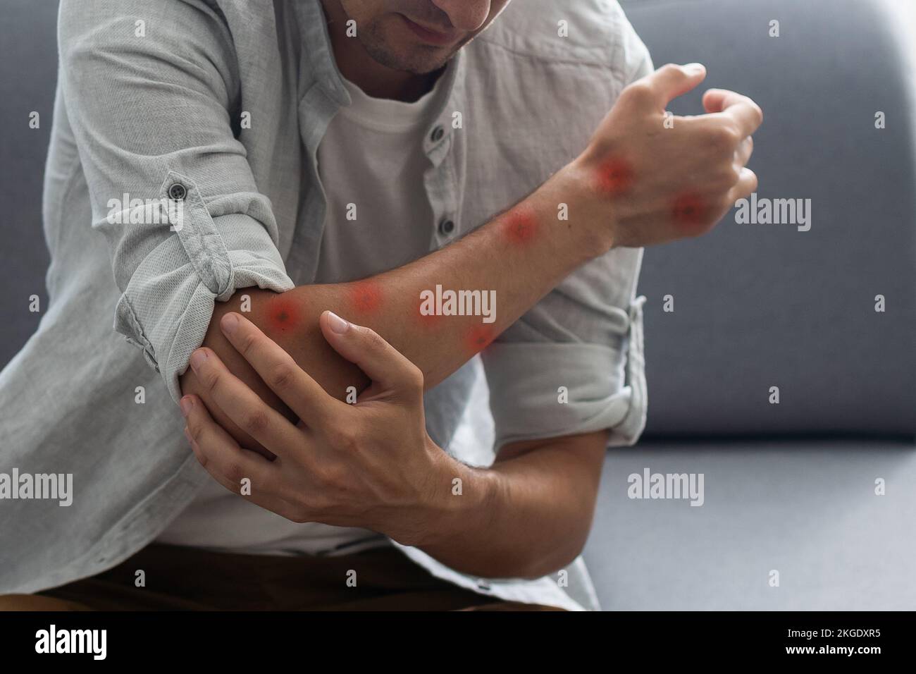 macchie rosse sulle mani Foto stock - Alamy