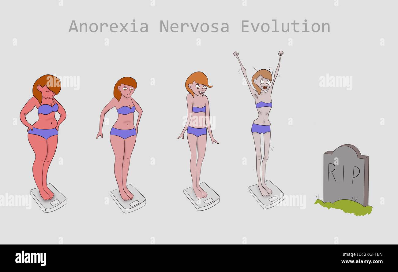 Illustrazione del concetto di evoluzione anoressia nervosa. Foto Stock