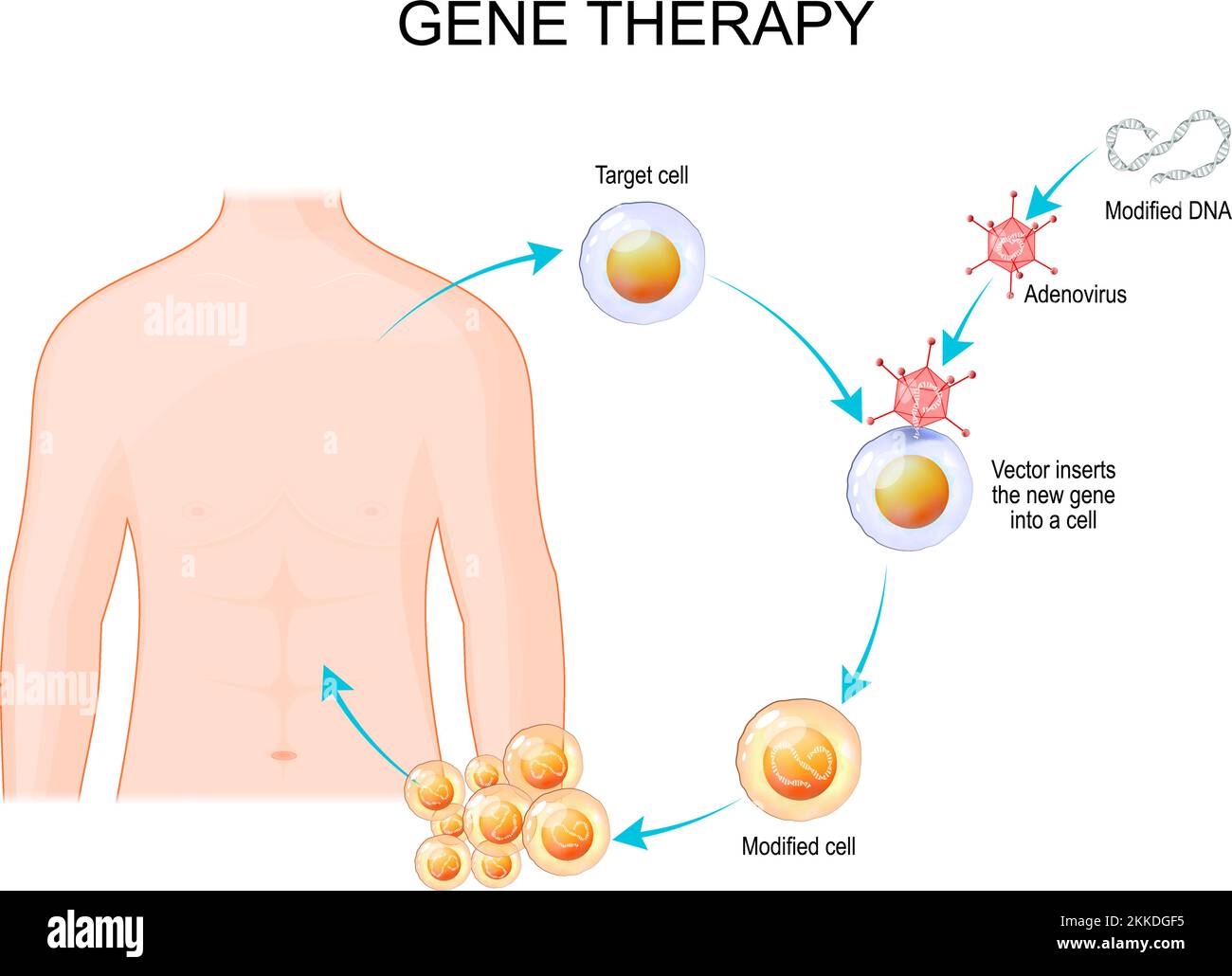 Ingegneria genetica. Terapia genica utilizzando un vettore adenovirus. il virus inserisce il nuovo gene in una cellula, che farà proteine per trattare una malattia Illustrazione Vettoriale