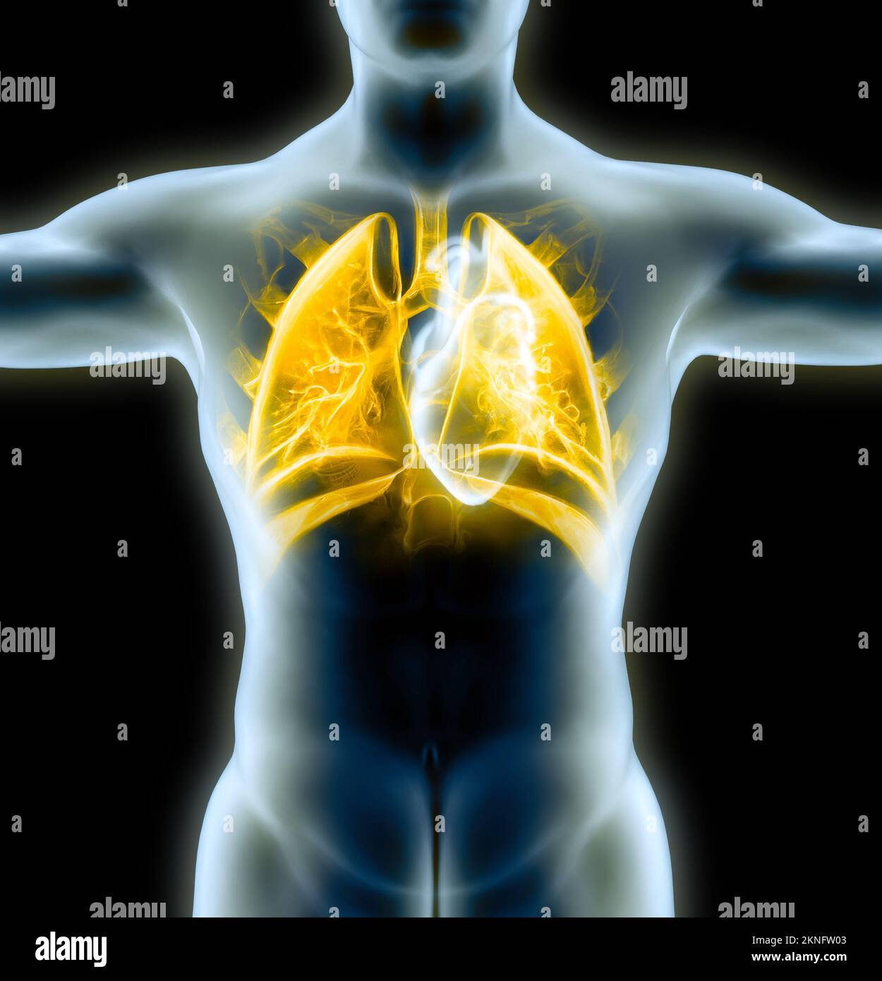Anatomia umana, problemi al sistema respiratorio, polmoni gravemente danneggiati. Polmonite bilaterale. Covid-19, coronavirus. Paziente e fumo. Fumatore Foto Stock