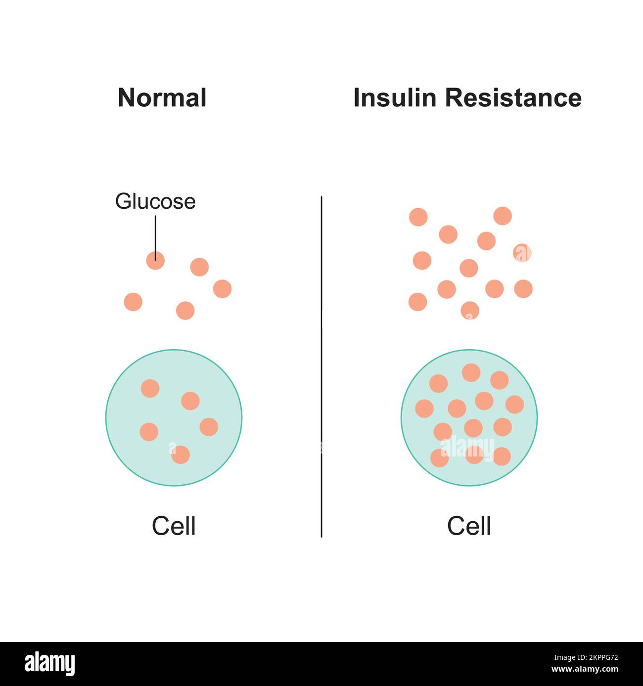 Concetto di resistenza all'insulina Design. Illustrazione vettoriale. Illustrazione Vettoriale