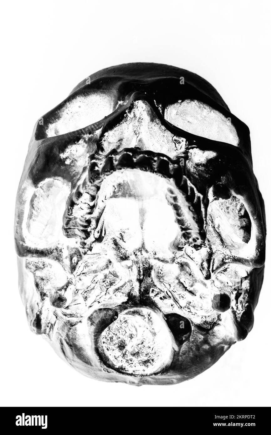 CSI x-ray art sulla linea di demarcazione di un cranio in un'esposizione medica negativa. Teschi e documenti dentali Foto Stock