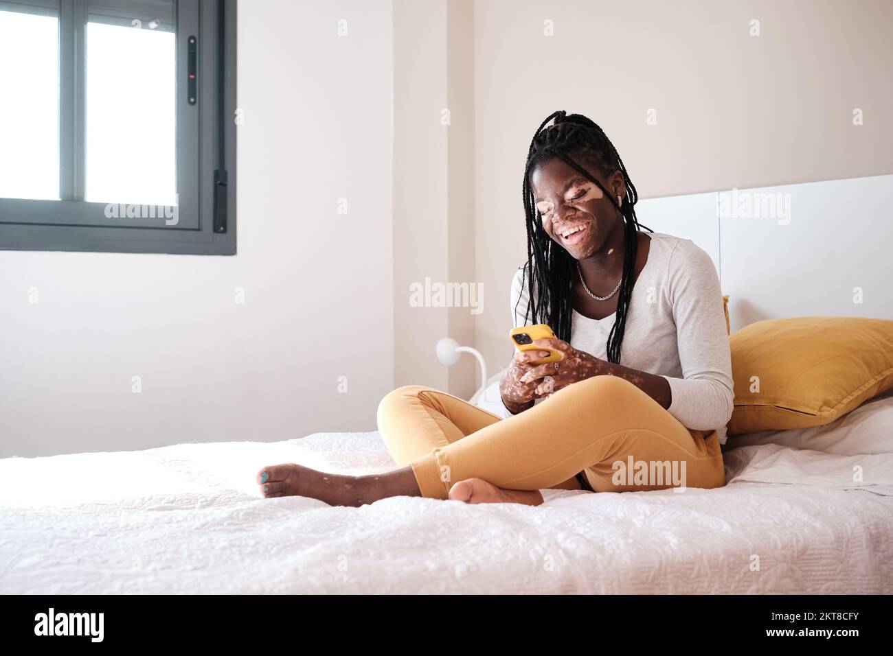 Allegra donna nera con vitiligine riposante a letto mentre navigano sul cellulare Foto Stock