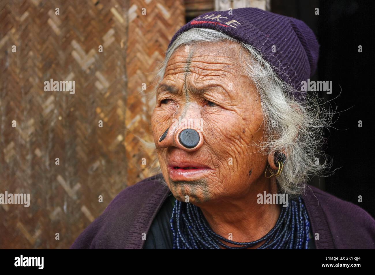 Ziro, Arunachal Pradesh, India - 02 24 2009 : Ritratto di tre quarti della vecchia donna tribale di Apatani con tatuaggi facciali tradizionali e tappi per il naso Foto Stock