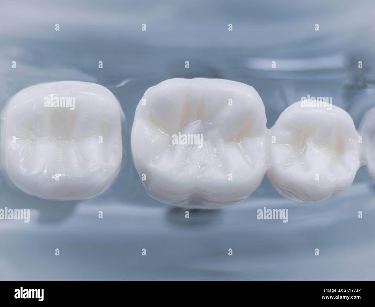 Primo piano dei denti di pratica odontoiatrica Foto Stock