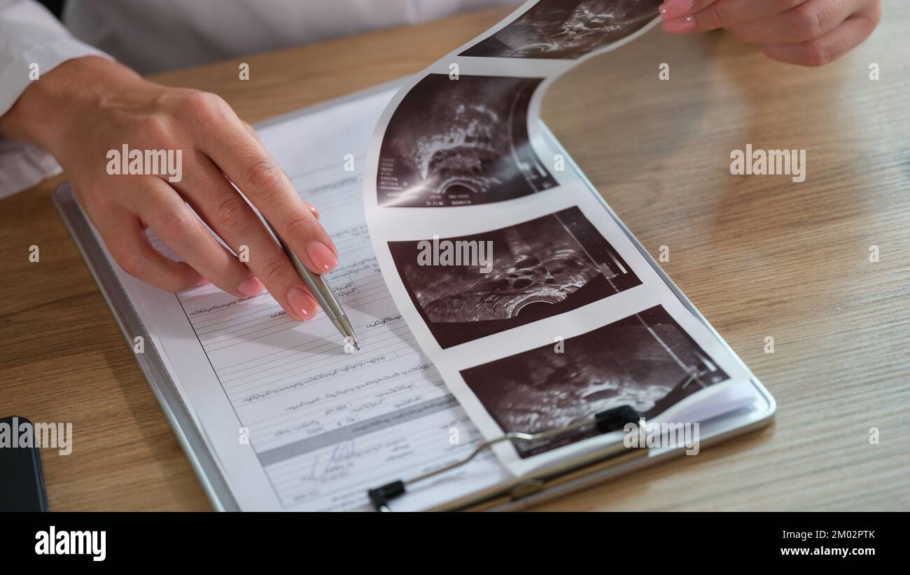 Primo piano del medico che compila la documentazione medica. Foto Stock