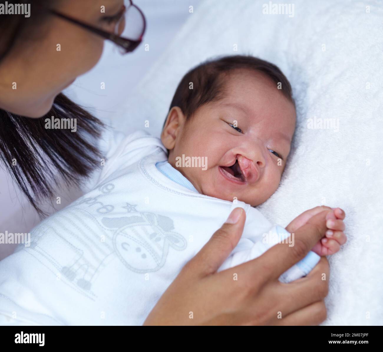 Mostrando la sua presa forte. Un bambino con un palato di spacco che tiene le sue madri dito e sorridente. Foto Stock