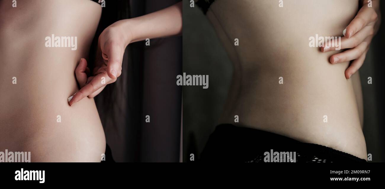 Lady applicare crema idratante lozione sul corpo. concetto di bellezza nad skincare. Foto Stock