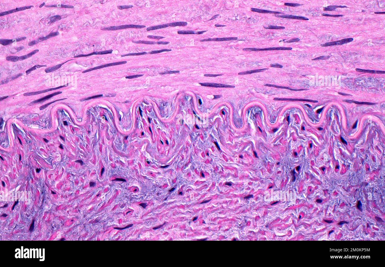 Lamina elastica arteriosa, micrografia leggera Foto Stock
