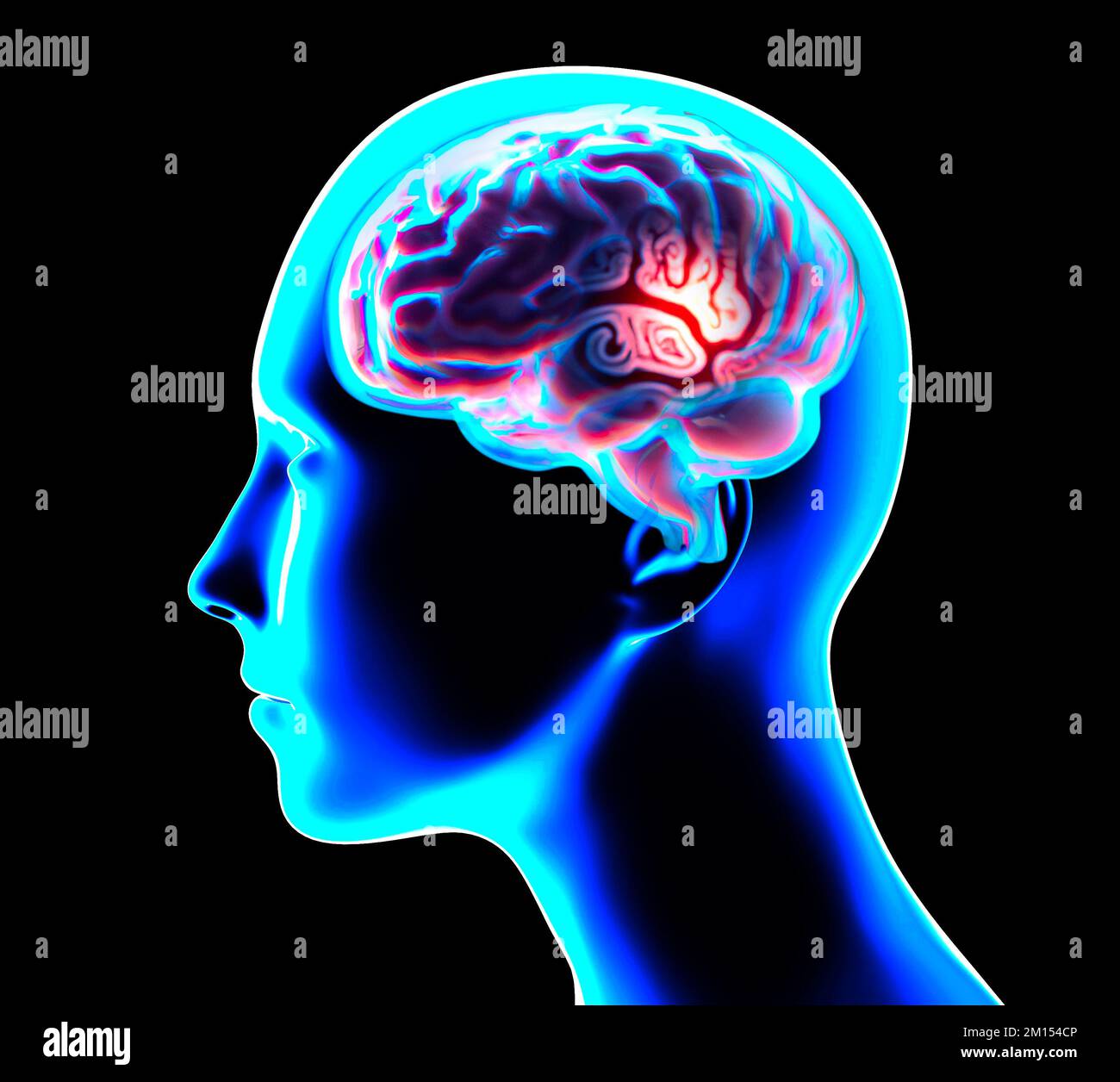 Sezione di un cervello visto in profilo, parti del cervello. Malattie degenerative, Parkinson, sinapsi, neuroni, Alzheimers. Anatomia umana, scansione cerebrale Foto Stock