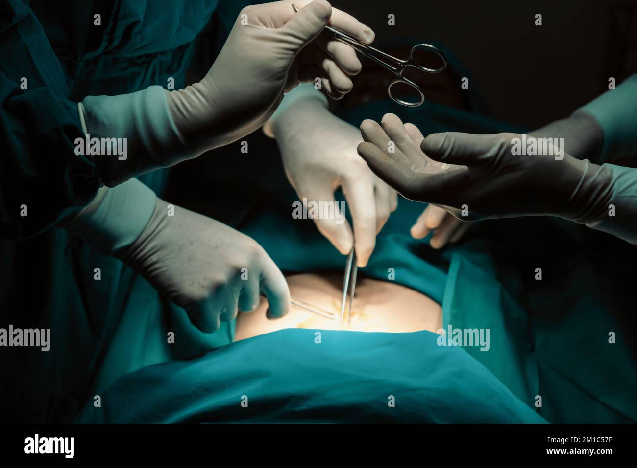 Immagine del team chirurgico eseguire l'operazione chirurgica, l'infermiere  distribuire le forbici sterili al chirurgo come supporto e cooperativa  nella sala operatoria concetto Foto stock - Alamy