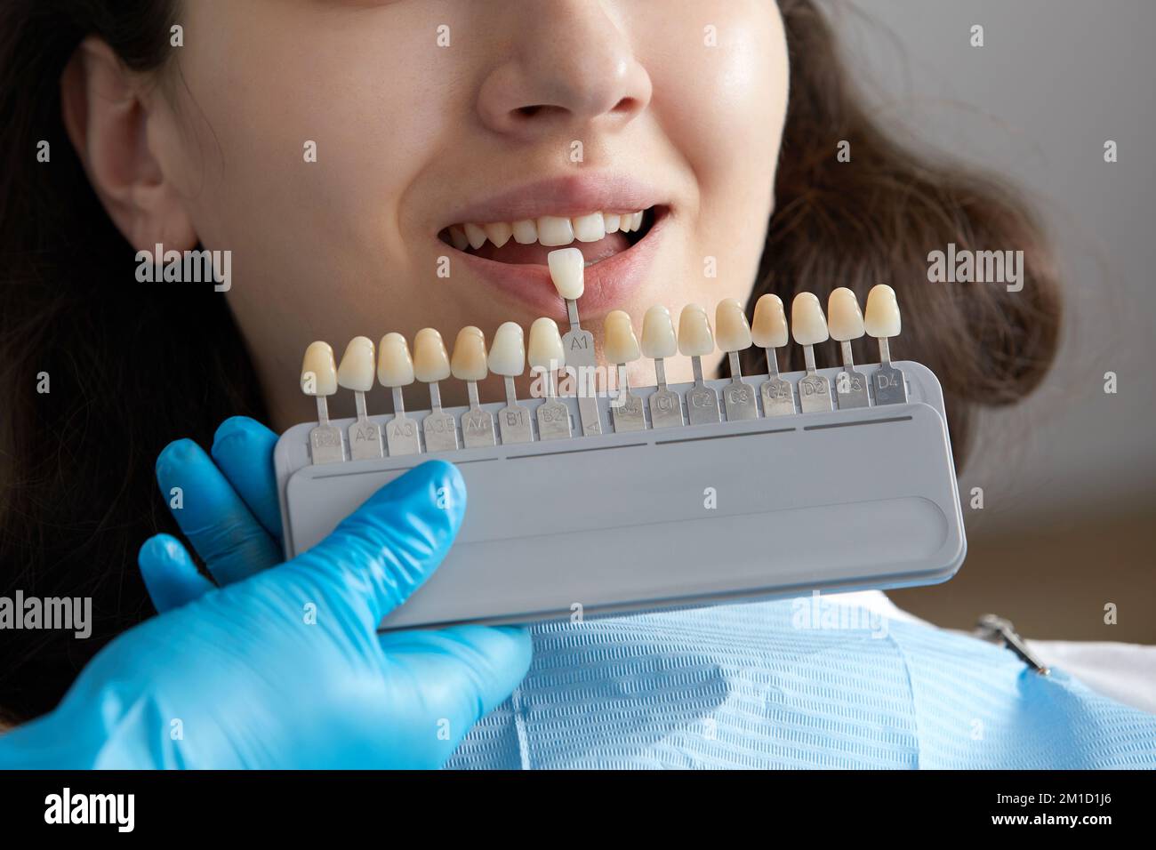 Dentista scelta tono colore di smalto dente per il paziente. Dentista che applica il campione dalla scala di smalto del dente Foto Stock