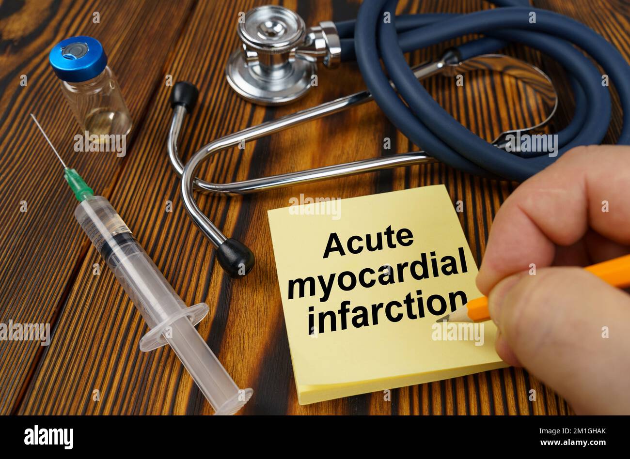 Concetto medico. Sul tavolo c'è uno stetoscopio, una siringa, una mano di un uomo con una penna fa un'iscrizione su un adesivo - infarto miocardico acuto Foto Stock