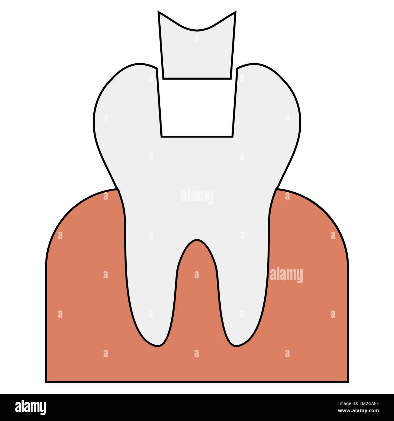 Icona riempimento corona denti restauro, infografica dentista riempimento dentario medico dentista Illustrazione Vettoriale