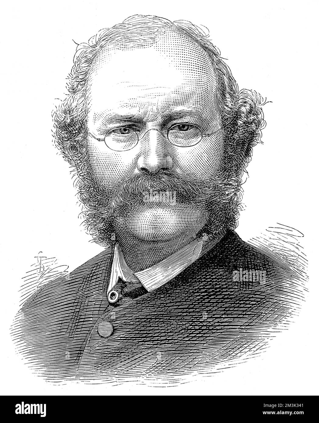 William Burges (1827 - 1881), l'associato della Royal Academy, ha ritratto poco prima della sua morte nel 1881. Foto Stock