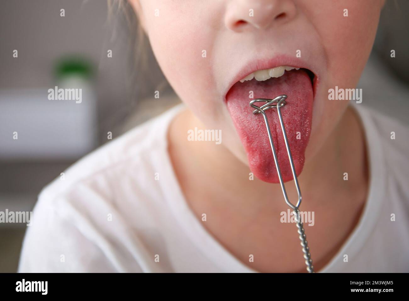 Al bambino viene somministrato un massaggio della lingua con una sonda per la terapia vocale. Foto Stock