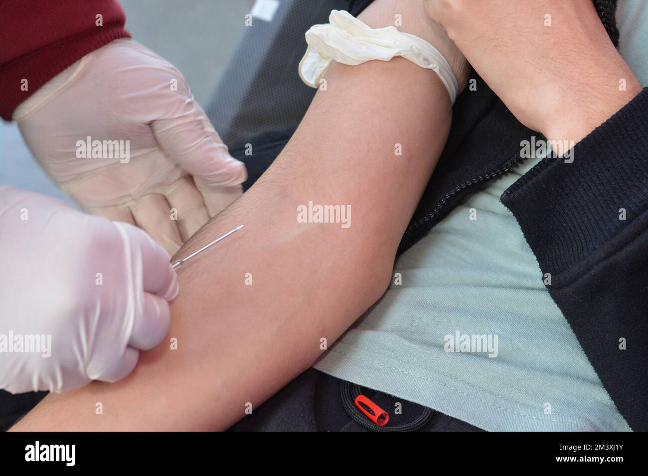 Donazione di sangue, un donatore di sangue volontario con e linea endovenosa raccolta di una sacca di sangue per beneficenza e bambini con talassemia e altre malattie, Foto Stock