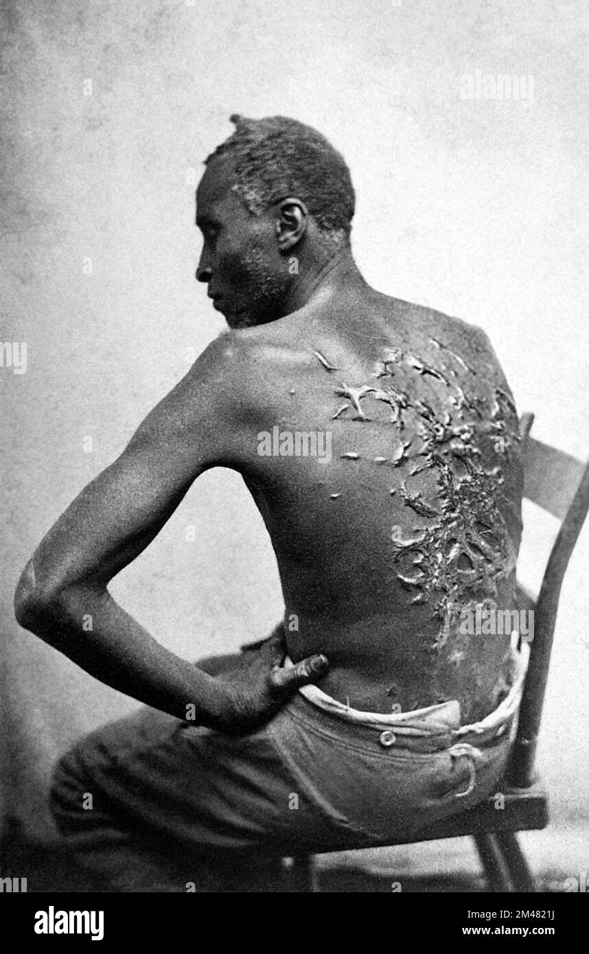 Frustò Peter o Gordon, uno schiavo fuggito che fu picchiato frequentemente. Foto di Matthew Brady, 1863. Foto Stock
