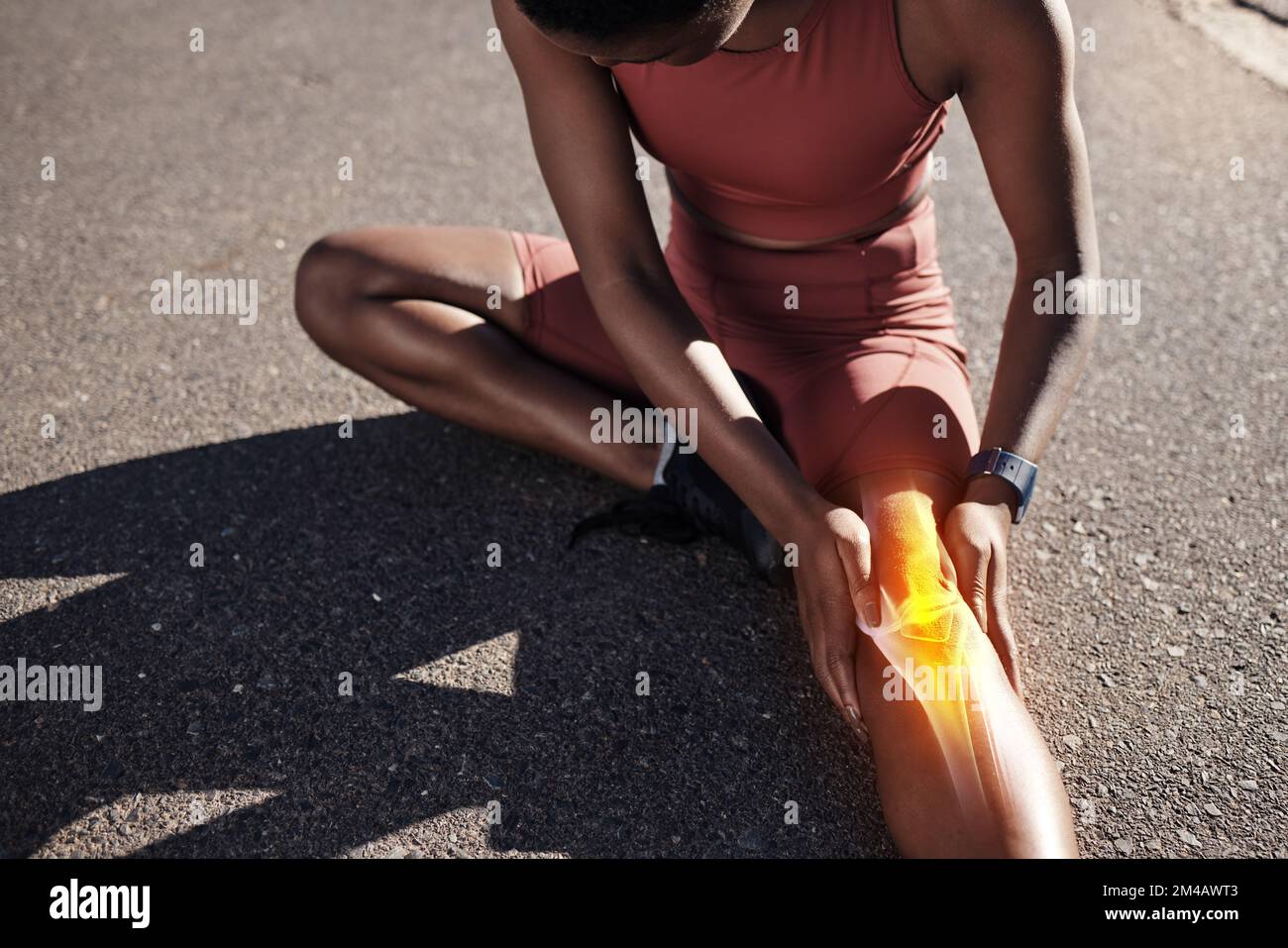 Raggi X, lesioni alle gambe e allenamento di donne nere con dolore medico, sforzo corporeo e emergenza durante una maratona sportiva. Doloroso, rotto muscolo e africano Foto Stock