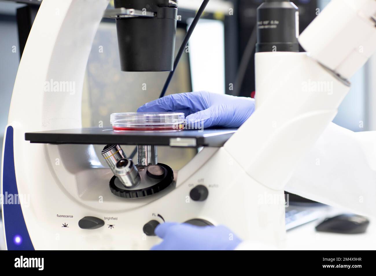 Scienziato con capsula di Petri che esamina il campione medico al microscopio Foto Stock