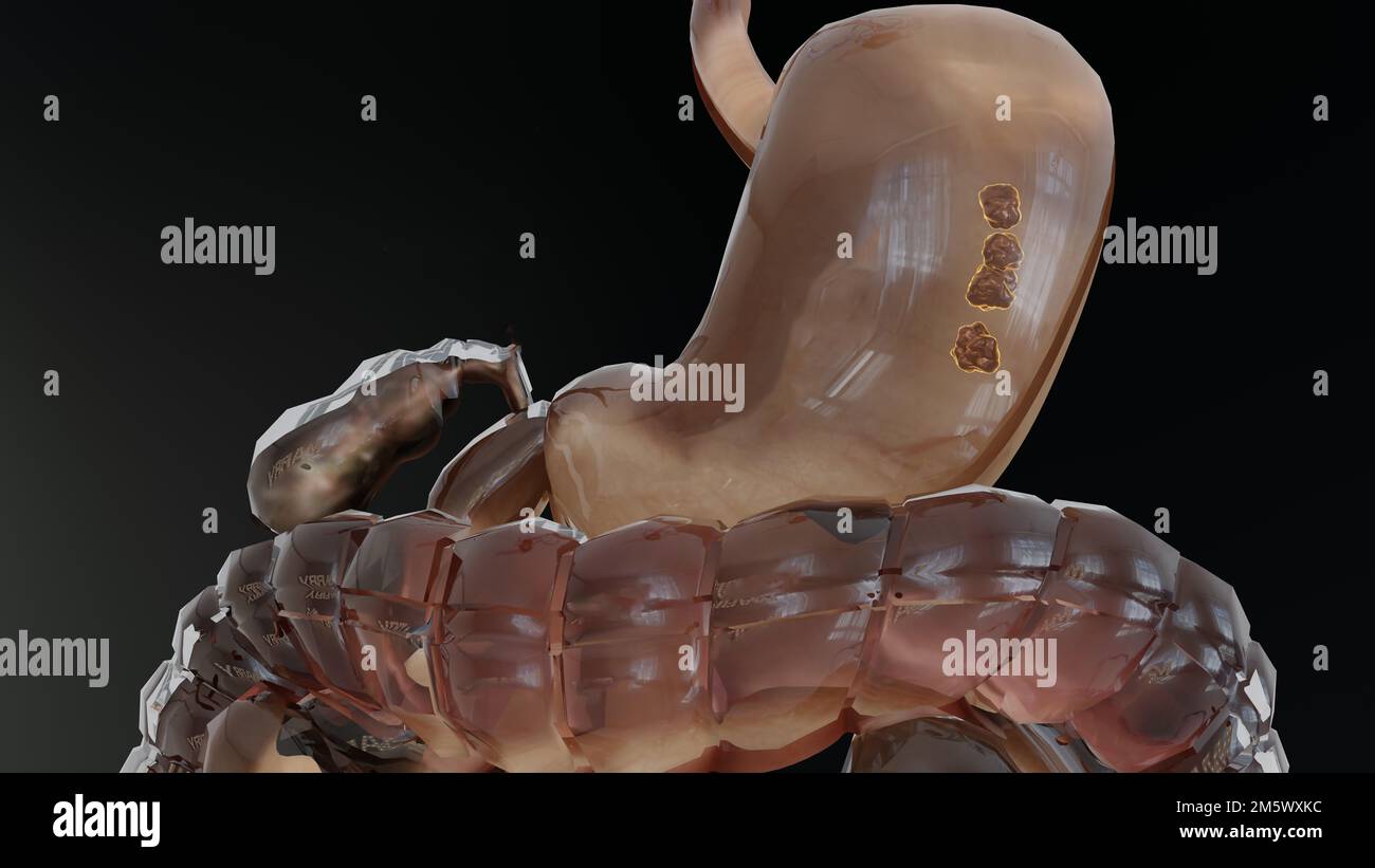 Stomaco umano digestione anatomica, concetto dell'intestino, dalla bocca all'intestino, lassativo, traito di costipazione, esofago, ingestione Foto Stock