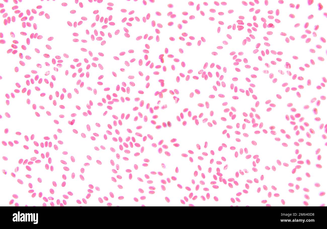 Sangue di pesce, striscio, 80X micrografia leggera. Eritrociti di sangue di pesce con micronuclei, sotto il microscopio luminoso. Foto Stock