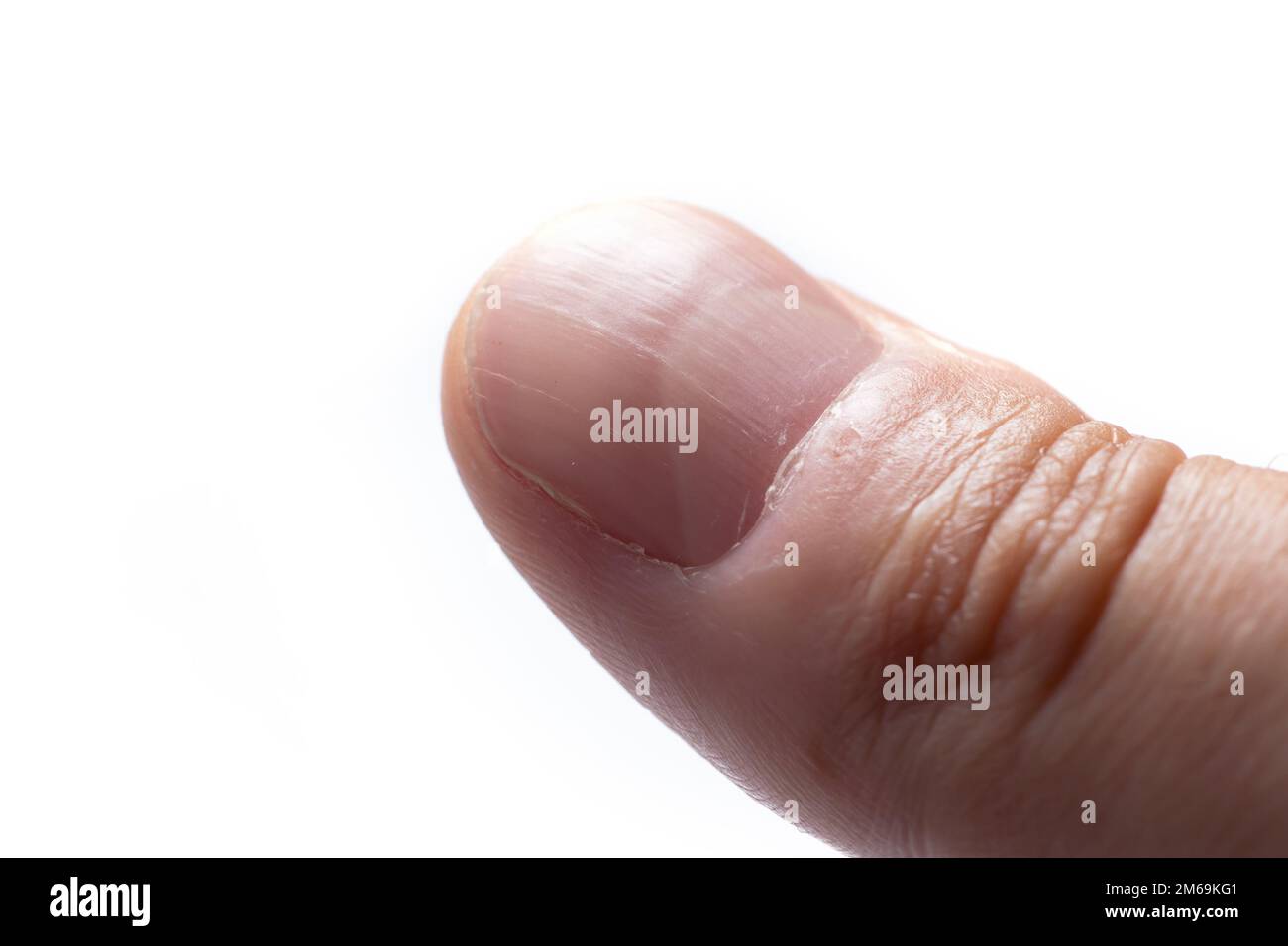 Mano con chiodi di copertura longitudinali isolati su sfondo bianco. Foto Stock