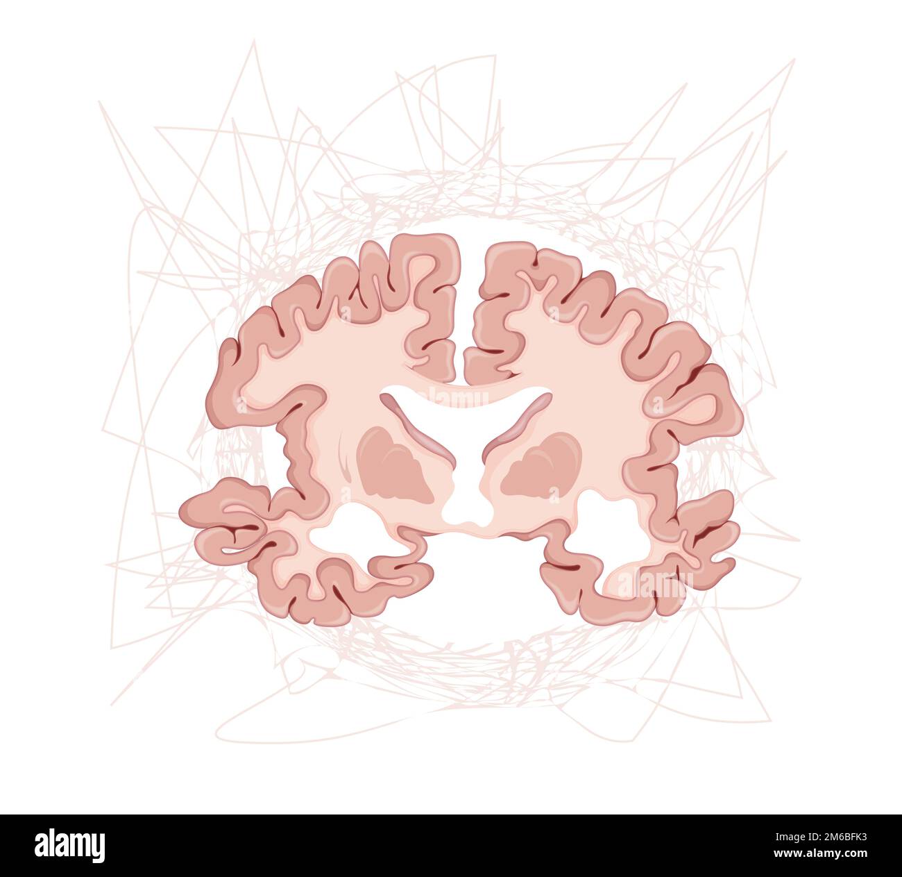 Morbo di Alzheimer - confusione - Sezione trasversale del cervello - Illustrazione come file EPS 10 Illustrazione Vettoriale