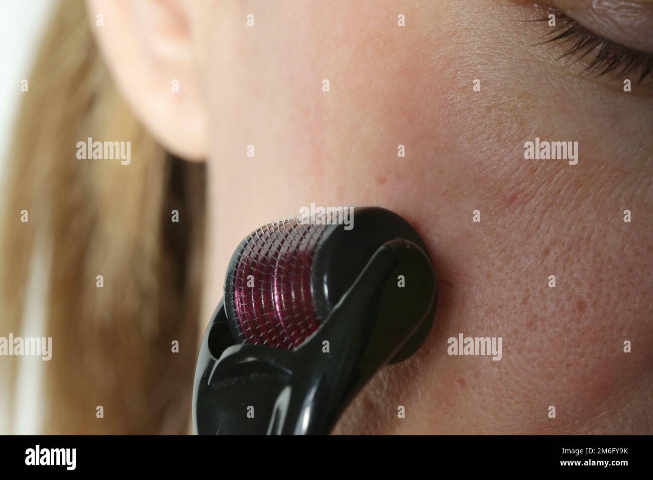 Massaggio facciale con microneedle dermaroller per il trattamento di cicatrici, rughe e ringiovanimento facciale. Cura della pelle semplice ed economica a casa, clos Foto Stock