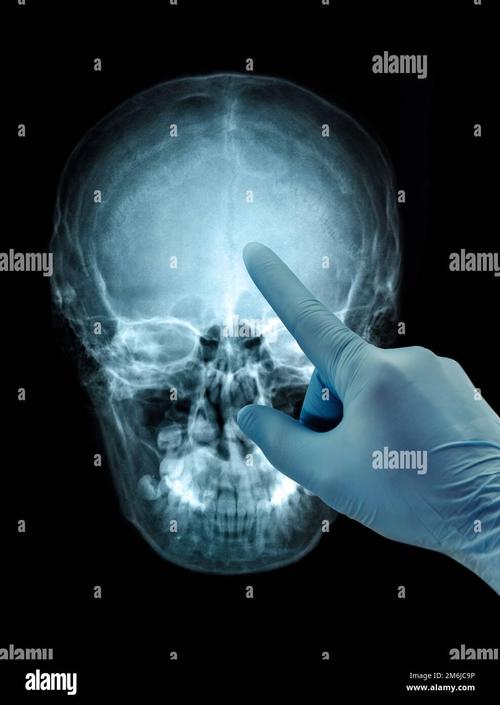 Cranio umano immagine radiografica vista frontale pellicola mano nel guanto Foto Stock