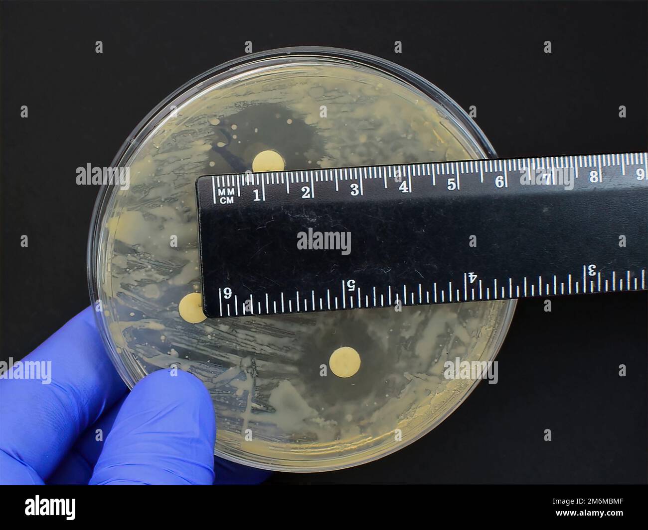 righello di misurazione interpretazione del test con disco di resistenza agli antibiotici antimicrobici Foto Stock