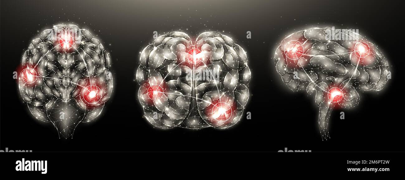 Illustrazione poligonale della malattia infiammatoria cerebrale umana su sfondo scuro. Cervello con infiammazione. basso design in poli. Disea Foto Stock