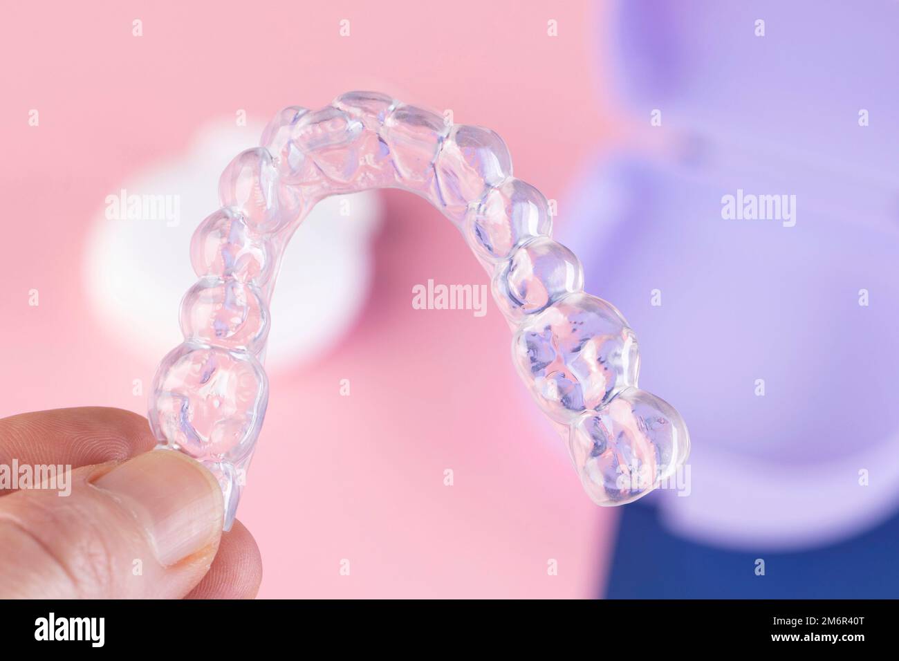 Trattamento ortodontico, bretelle invisibili, nuova tecnologia ortodontica, stecca occlusale Foto Stock