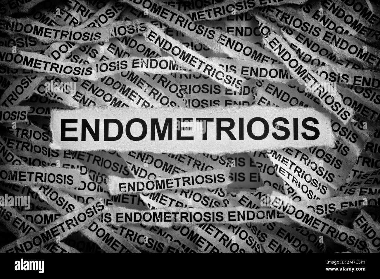 Strisce di giornale con le parole endometriosi digitate su di loro. Bianco e nero. Primo piano. Foto Stock