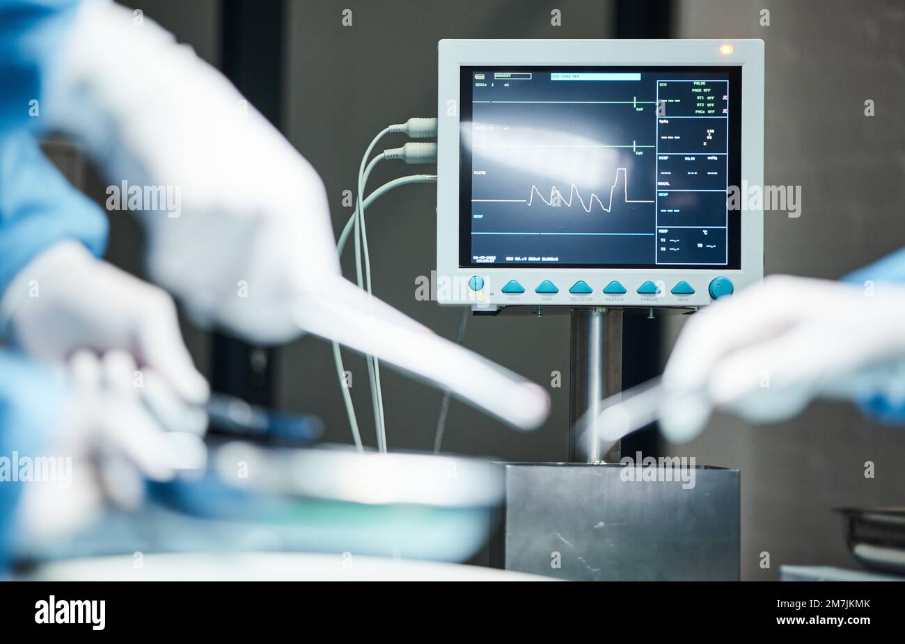 Elettrocardiogramma, mani di medici con bisturi o squadra per chirurgia, assistenza sanitaria o assistenza medica. Zoom, monitor o mano dell'infermiere in teatro per la fiducia Foto Stock