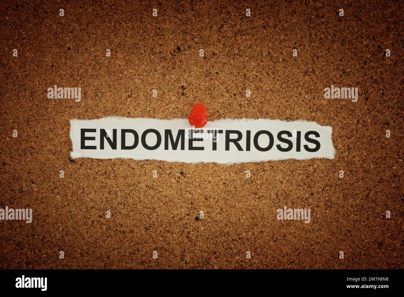 Una nota di carta con la parola endometriosi su di essa fissata ad una tavola di sughero. Primo piano. Foto Stock