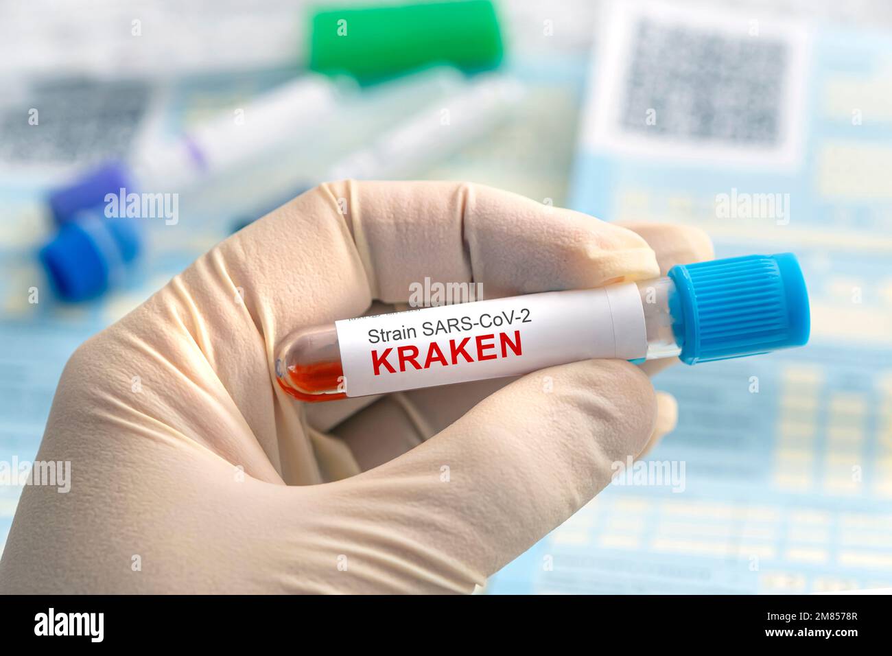 Medico con un campione di sangue positivo per la nuova variante rilevata del ceppo di coronavirus africano chiamato Omicron kraken. Ricerca di nuovi ceppi e muta Foto Stock
