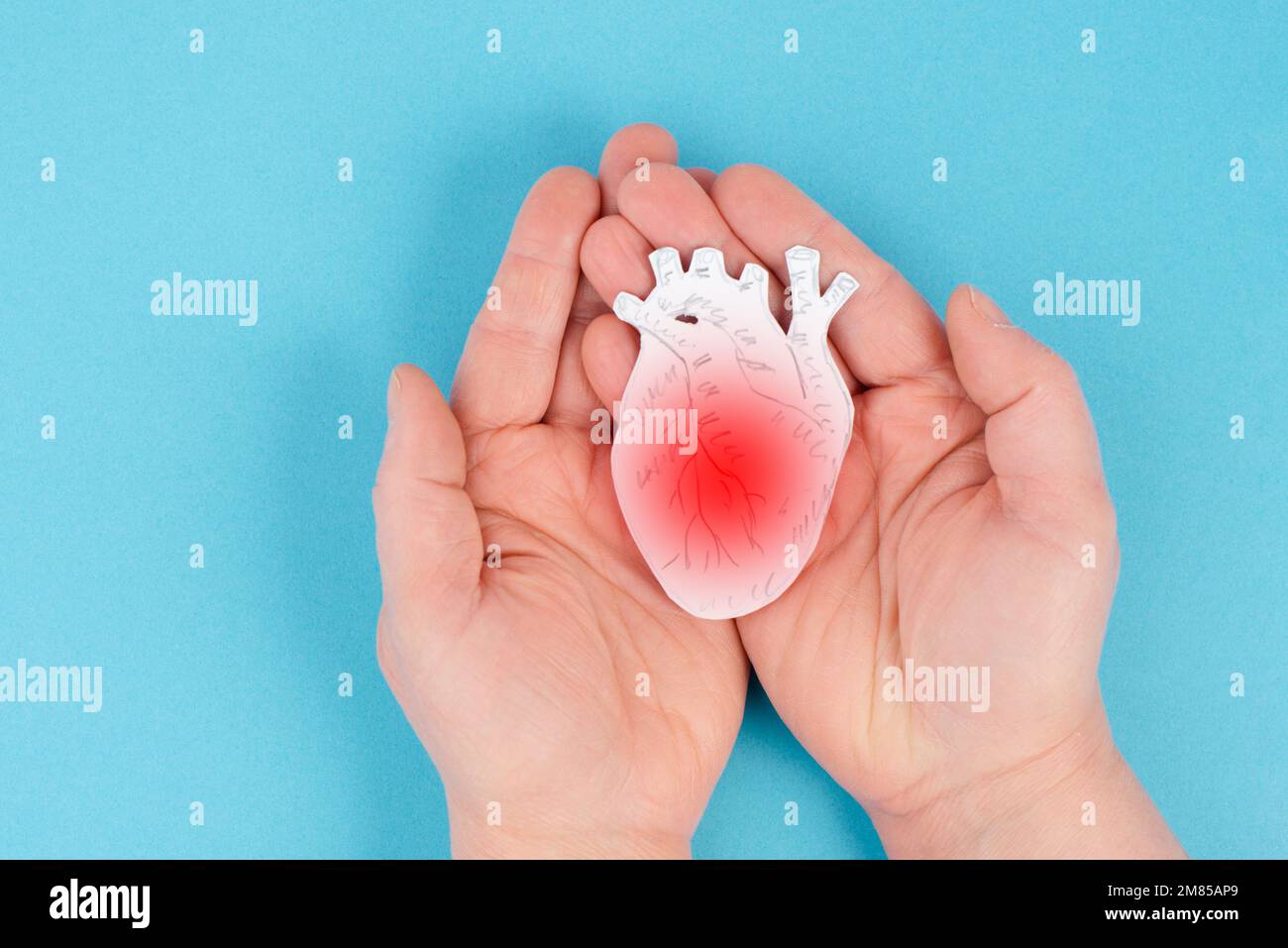 Attacco cardiaco, effetto collaterale miocardite delle siringhe Covid-19, infiammazione muscolare, cardiopatia, trombosi dopo il vaccino Foto Stock
