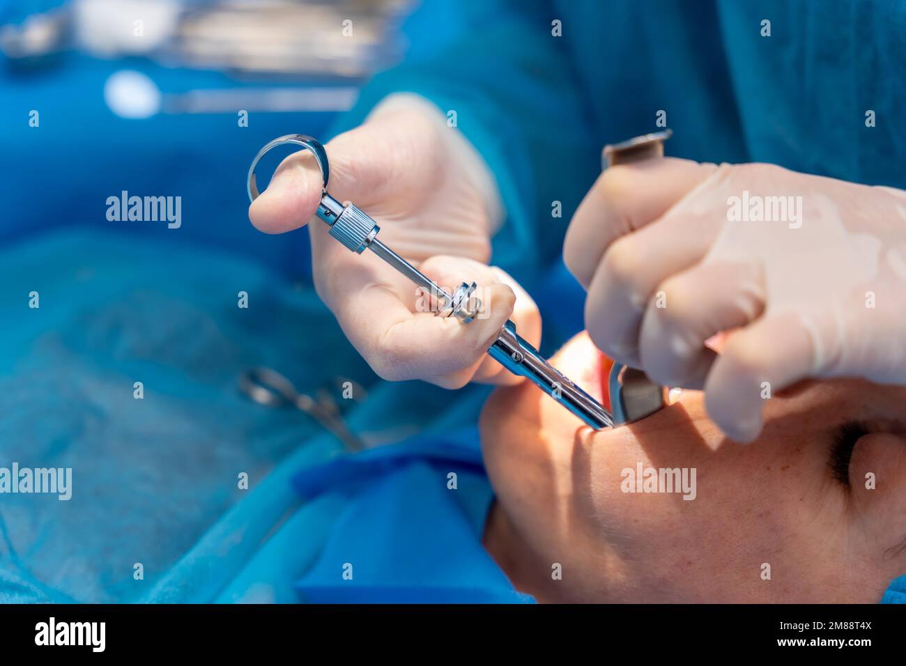 Clinica odontoiatrica, medico dentista che applica un'iniezione anestetica al paziente nella parte inferiore della bocca Foto Stock