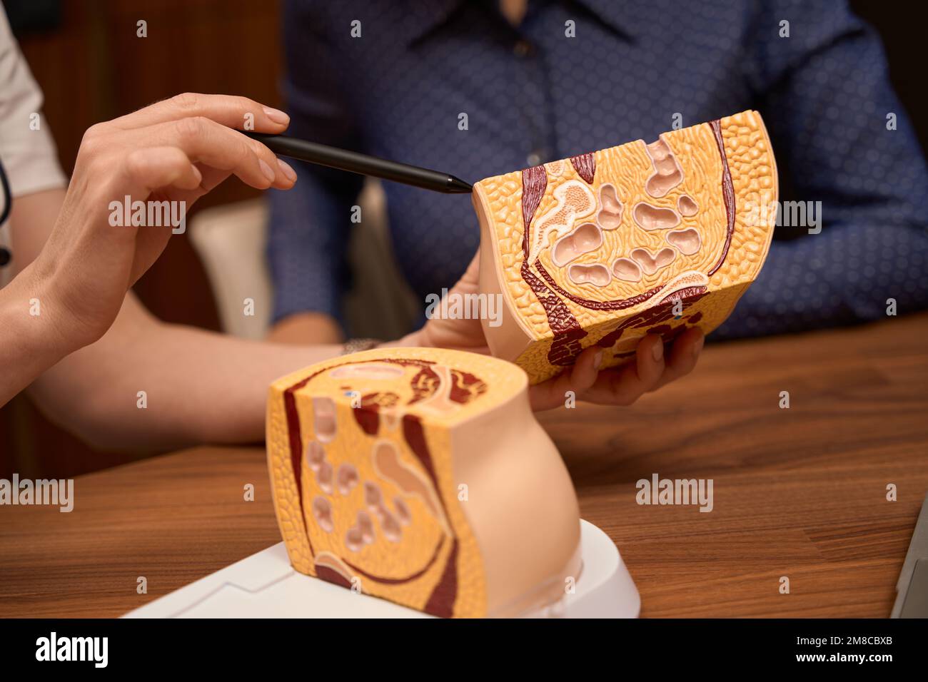 Donna che guarda il campione di pavimento pelvico in clinica Foto Stock