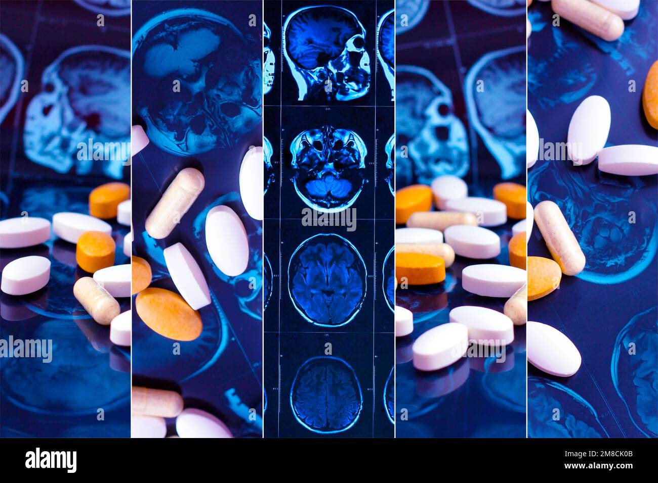 Diverse pillole di medicina farmaceutica sulla risonanza magnetica del cervello risonanza collage di sfondo mri. Tema farmacia, assistenza sanitaria, prescrizione di farmaci per tu Foto Stock