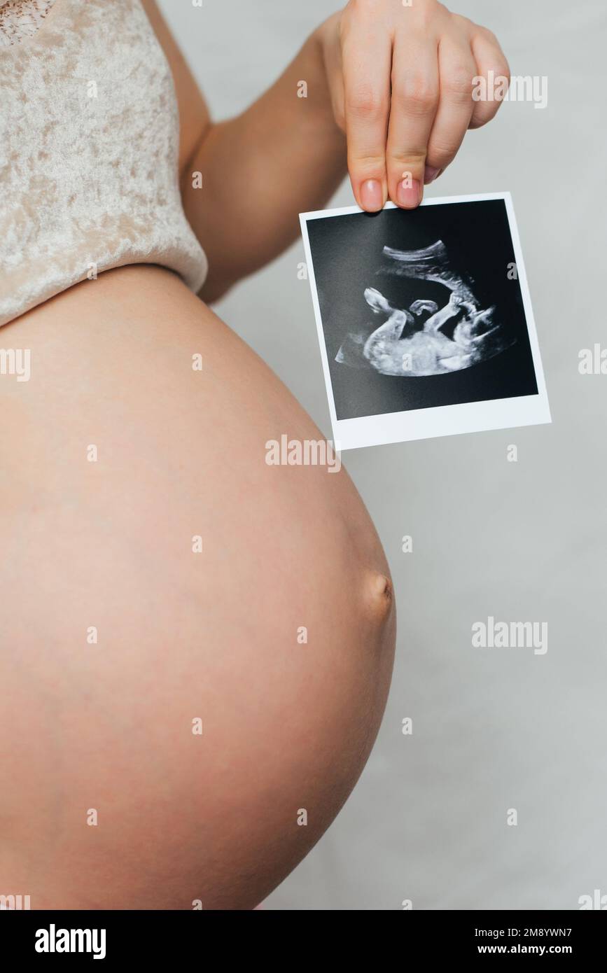 foto di una ecografia incinta nelle mani di una ragazza incinta sullo sfondo dell'addome Foto Stock