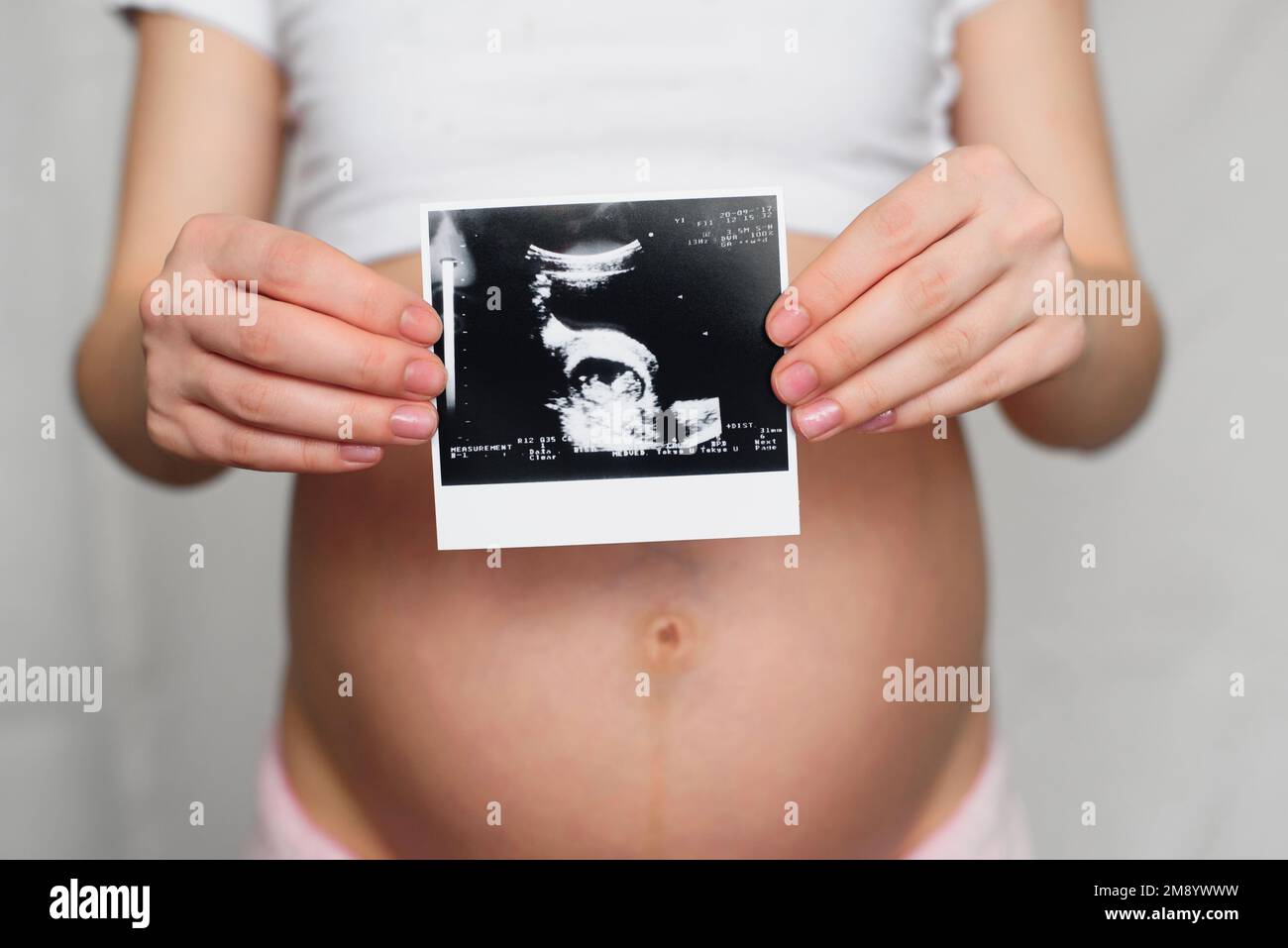 foto di una ecografia incinta nelle mani di una ragazza incinta sullo sfondo dell'addome Foto Stock
