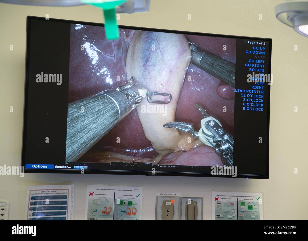 220516-N-XZ205-1101 SAN DIEGO (13 maggio 2022) Una foto di un video monitor laparoscopico come un operatore controlla un sistema di robot chirurgico multi-braccio durante un intervento di rimozione della cistifellea assistita da robot al Navy Medicine Readiness and Training Command (NMRTC) San Diego maggio 16. Durante l'intervento chirurgico, i membri dello staff di NMRTC San Diego hanno comunicato con i membri dello staff del Naval Hospital Camp Pendleton in remoto, in base al protocollo approvato, per il telementoring. La missione di NMRTC San Diego è quella di preparare i membri del servizio a schierarsi a sostegno delle forze operative, fornire servizi sanitari di alta qualità e plasmare il futuro di Foto Stock