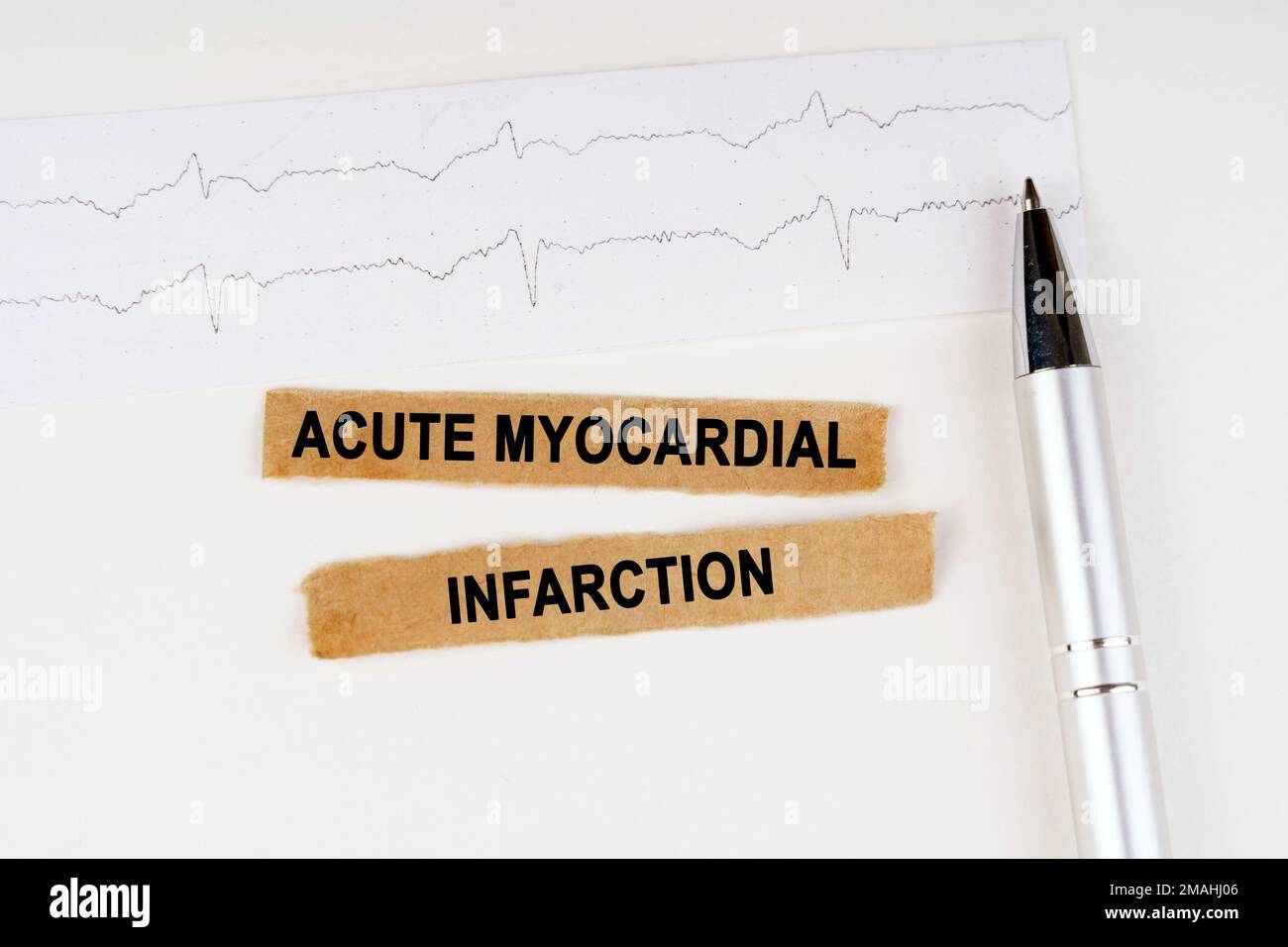 Concetto medico. Sul cardiogramma si trova una penna e carta strappata con il testo - infarto miocardico acuto Foto Stock
