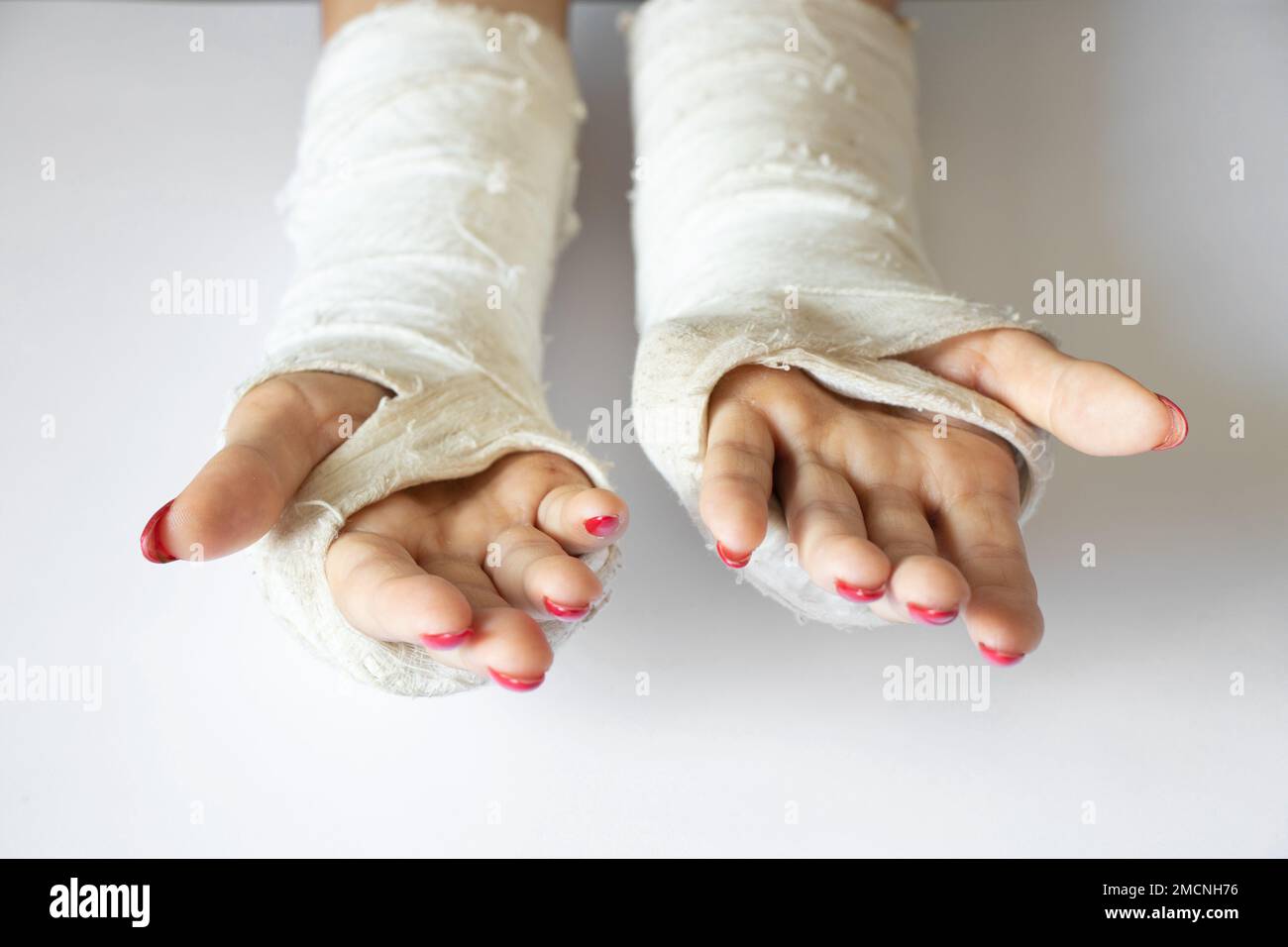 due mani femmine con polsi rotti dopo essere caduto da una bicicletta in un cast su uno sfondo isolato, mani in un cast Foto Stock